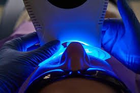 Coollight teeth whitening